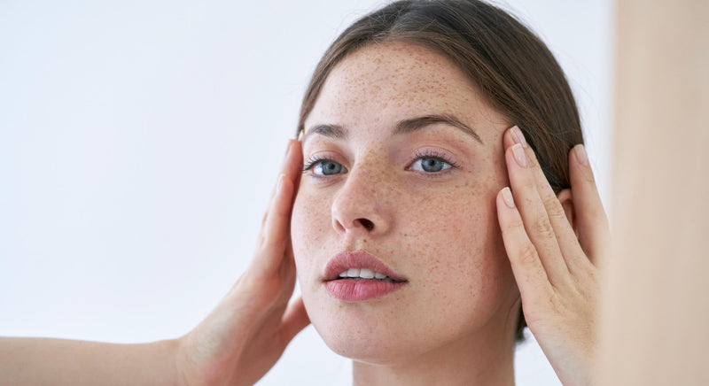 Masque de grossesse : comment l'éviter quand on est enceinte ?