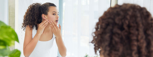 Image Comment reconnaître et lutter contre l’acné hormonale ?