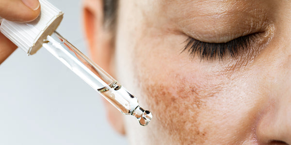 Image Taches brunes : comment trouver le meilleur sérum anti-taches ?