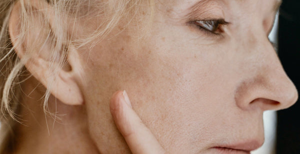 Image Comment atténuer les taches brunes sur le visage ?