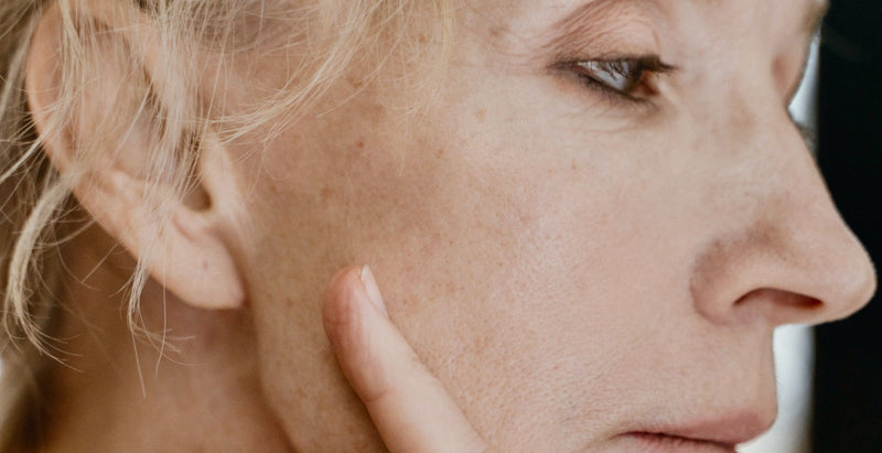 Comment atténuer les taches brunes sur le visage ?