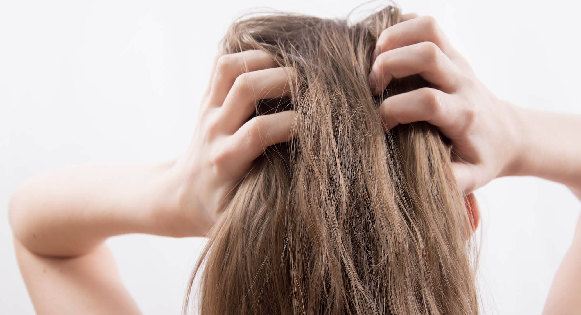Comment faire quand on a du psoriasis sur le cuir chevelu ?