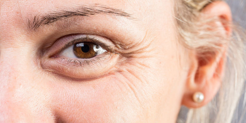 Rides sous les yeux : comment leur dire adieu ?