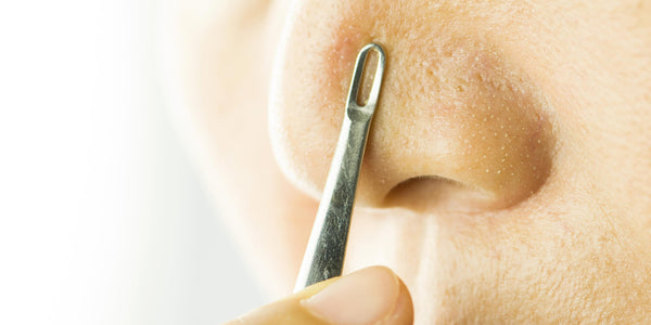 Image Tire-comédon : voilà comment bien l'utiliser !