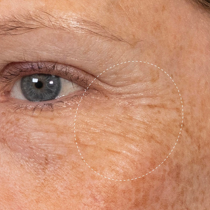 Krème Sérum Yeux Collagène Anti-Rides avant-après