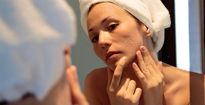 Comment réduire les cicatrices sur le visage ?