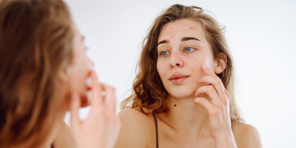 Image J'ai la peau grasse et déshydratée : comment faire ?