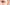 Image Rides sous les yeux : comment leur dire adieu ?