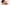 Image Comment reconnaître son type de poches sous les yeux ?