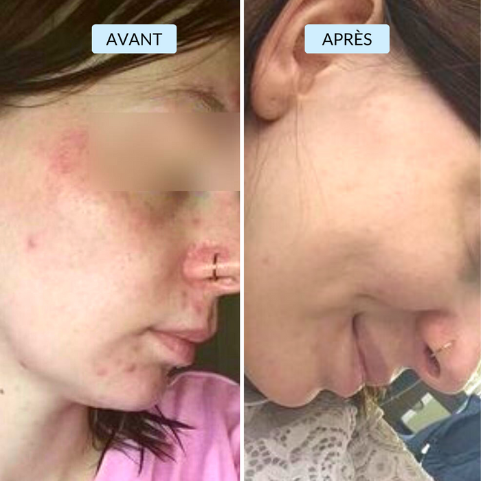 Alice, 28 ans