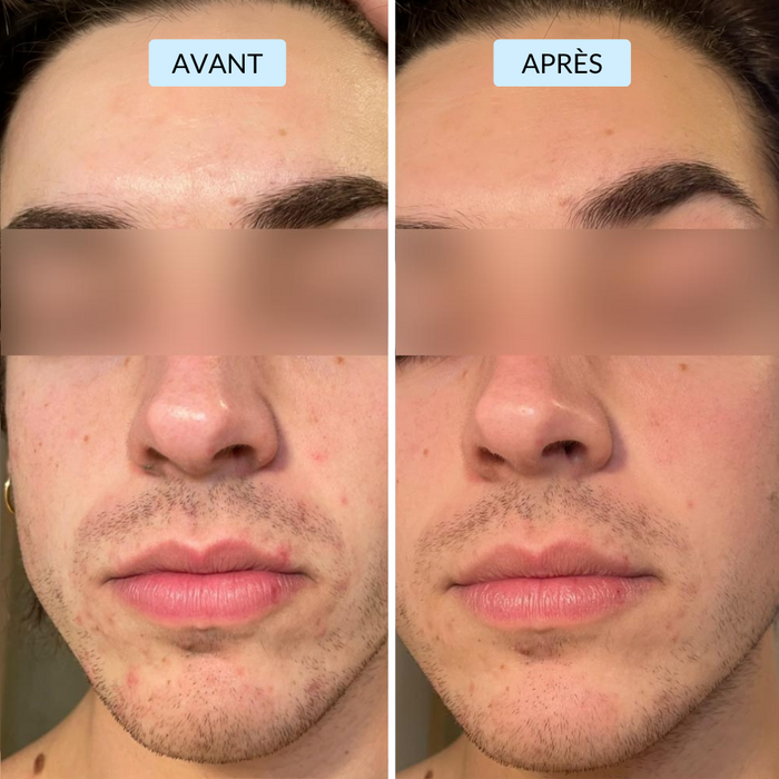 Antoine, 25 ans