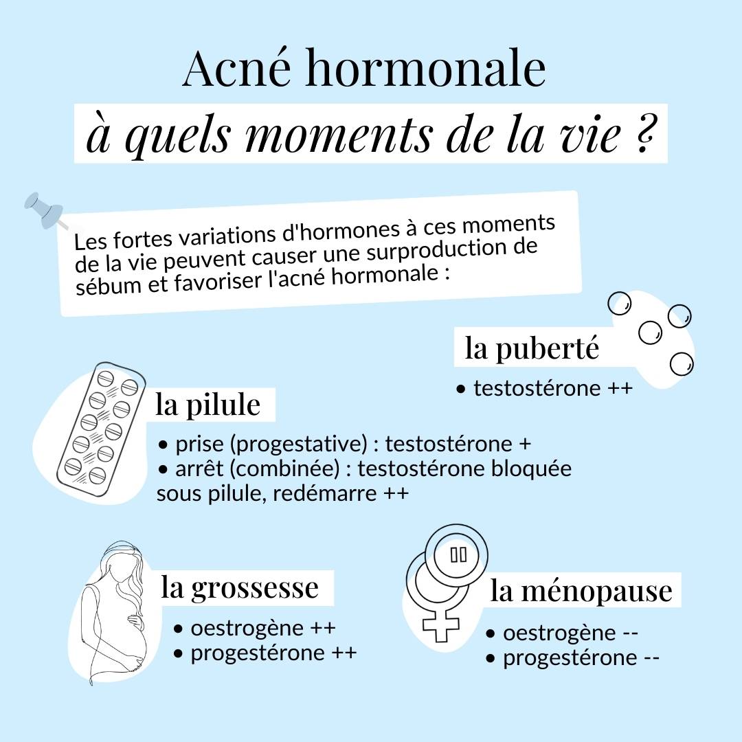 Quand peut-on faire de l'acné hormonale ?