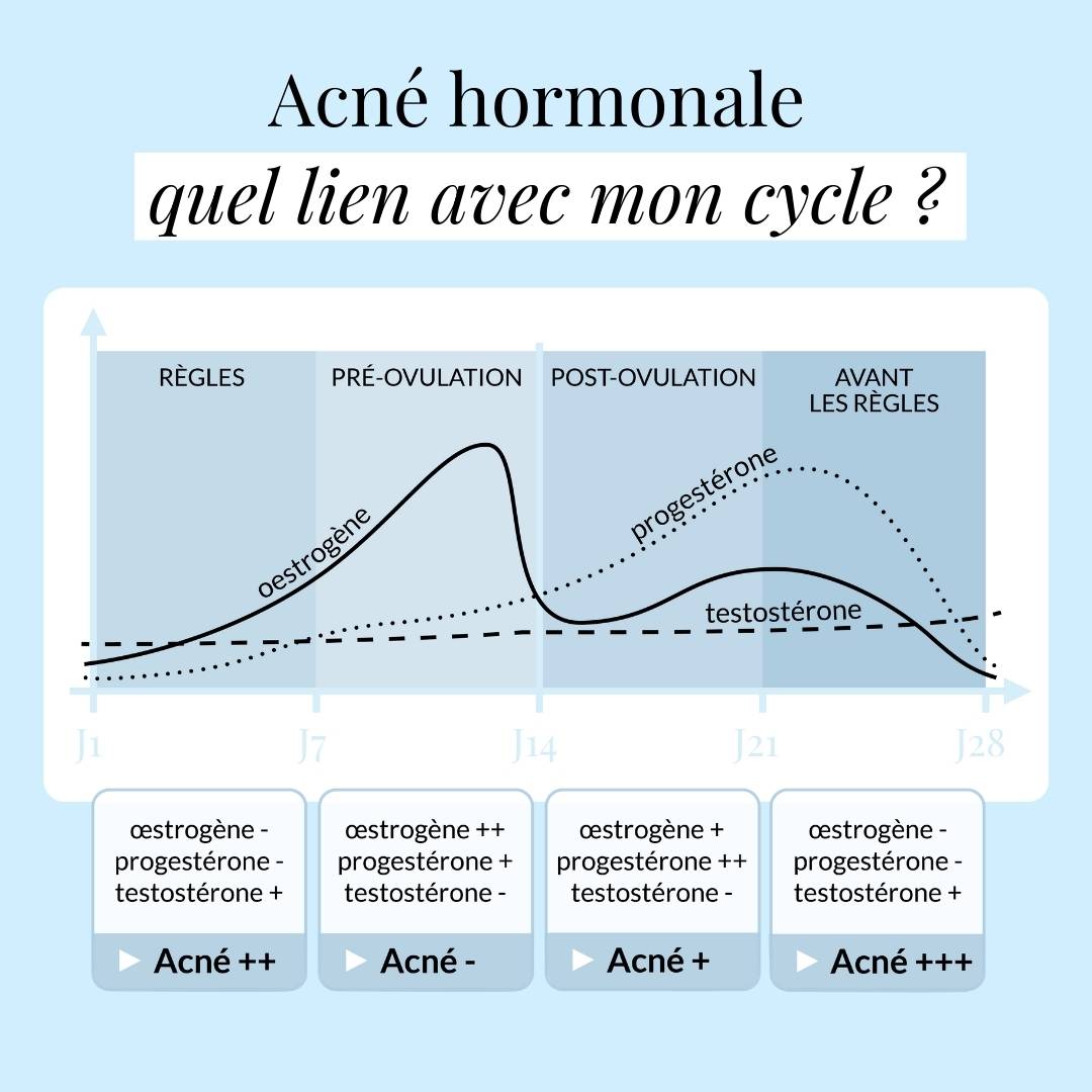 L'acné et le cycle hormonale