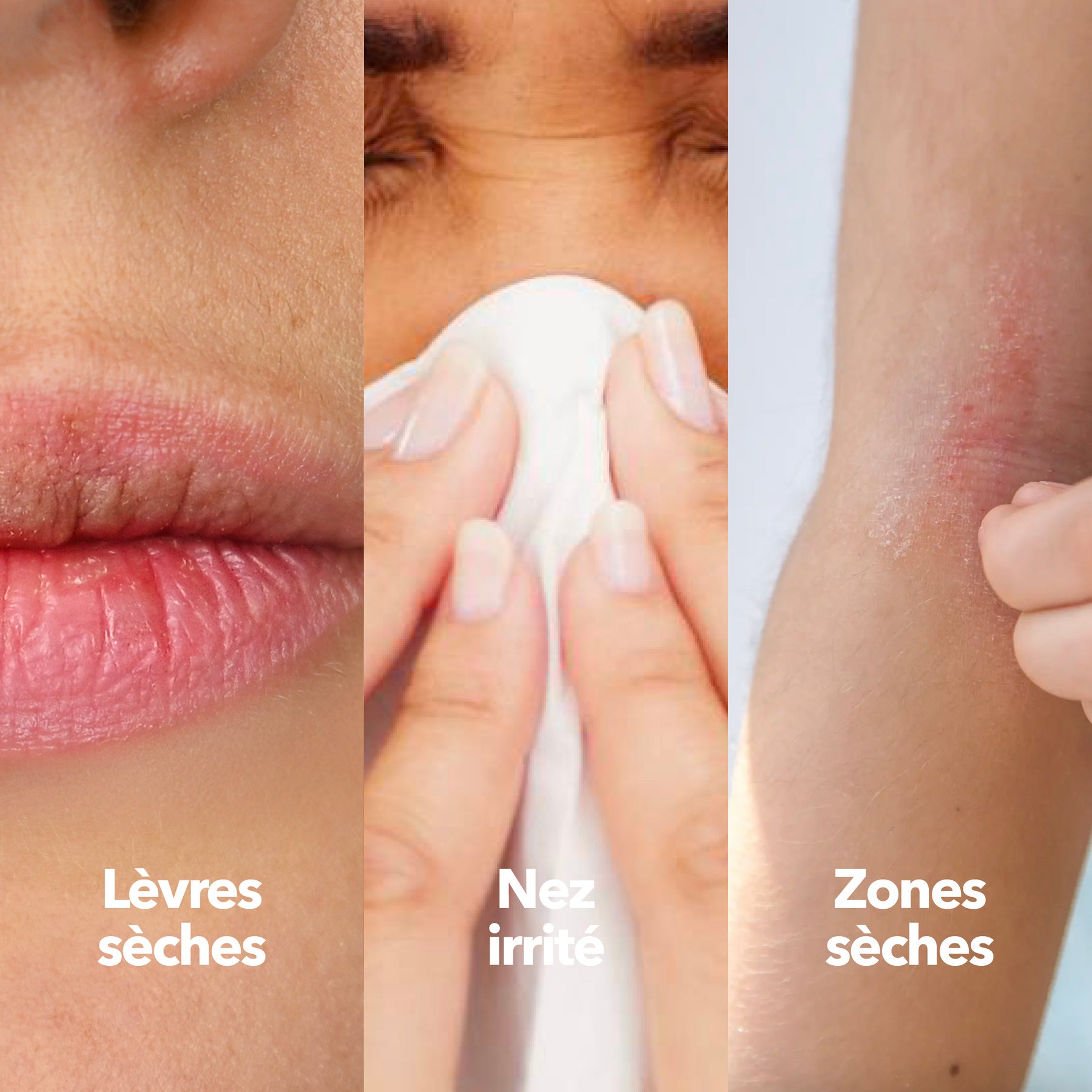 Baume Réparateur Sécheresse Irritation