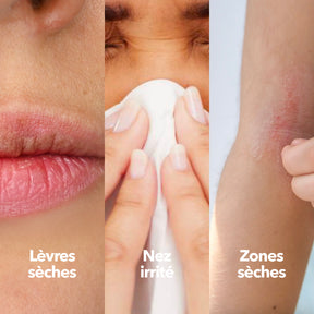 Baume Réparateur Sécheresse Irritation