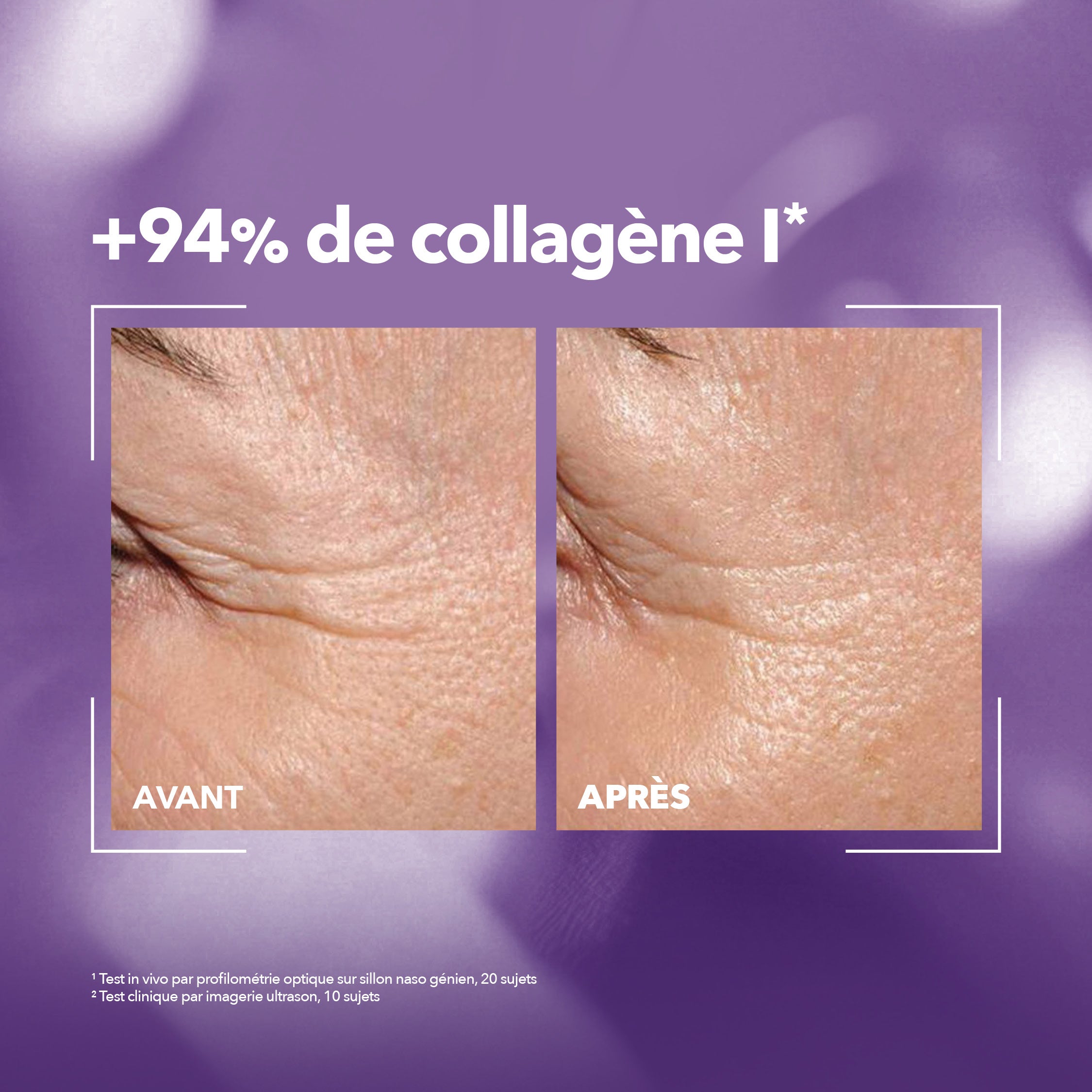 Avant après Sérum Collagène Krème