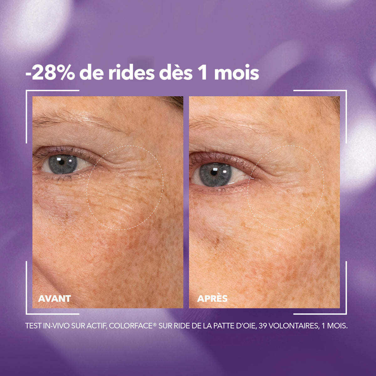 Krème Sérum Yeux Collagène Anti-Rides avant-après