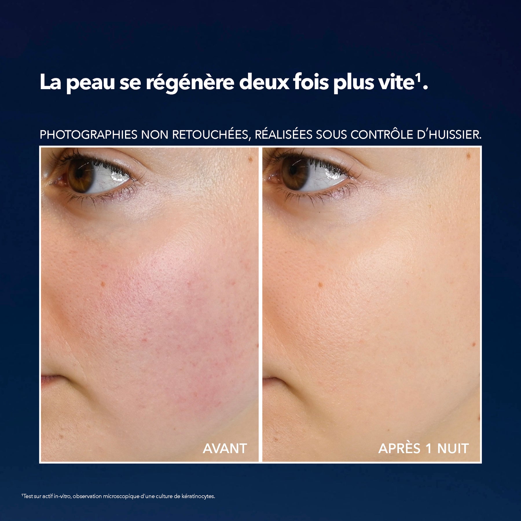 Masque de Nuit Anti-Soif