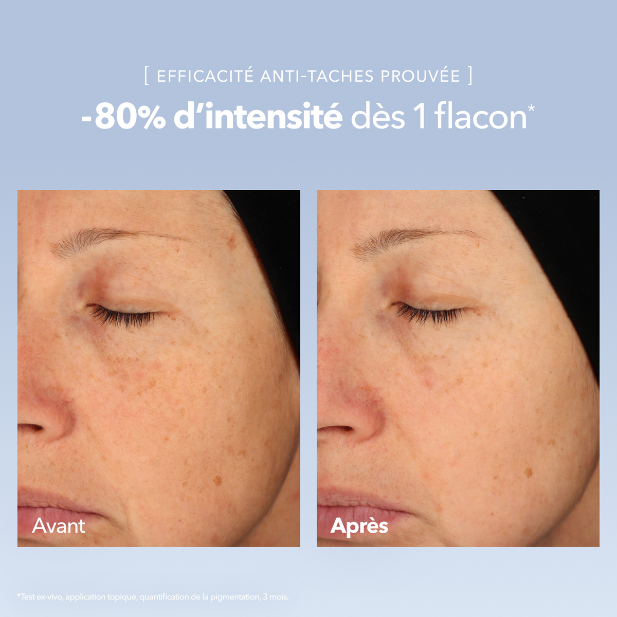 Sérum Concentré Anti-Taches
