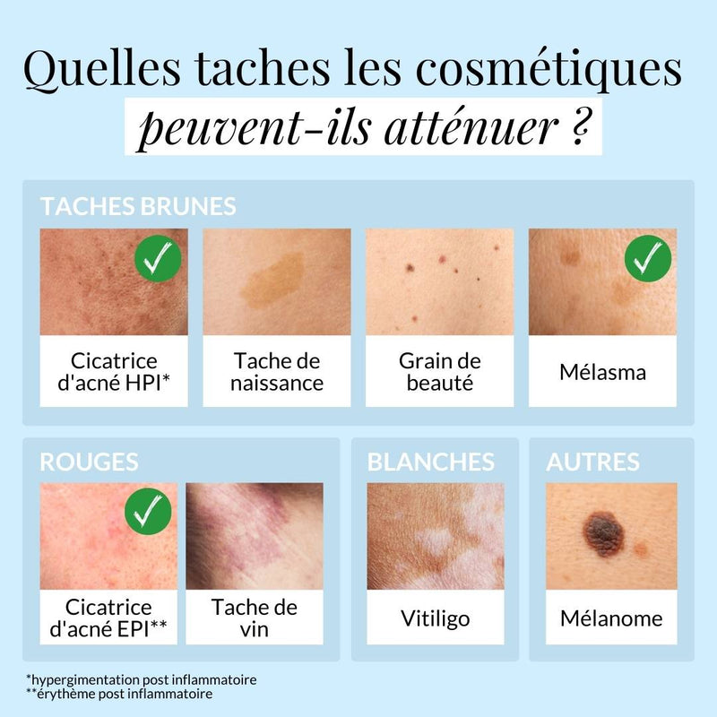 Les taches qui peuvent s'atténuer avec les cosmétiques