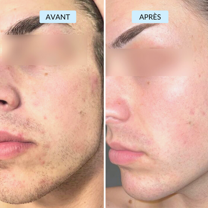 Antoine, 25 ans