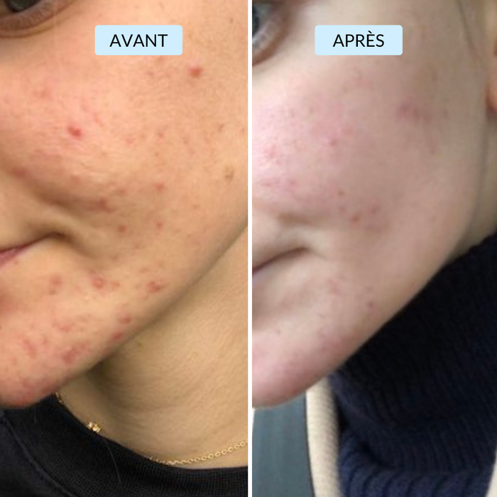 Apolline, 23 ans